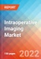Intraoperative Imaging Market Insights, Competitive Landscape and Market Forecast-2027 - Product Thumbnail Image