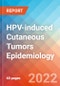HPV-induced Cutaneous Tumors - Epidemiology Forecast to 2032 - Product Thumbnail Image