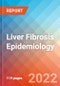 Liver Fibrosis - Epidemiology Forecast - 2032 - Product Image