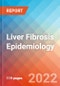 Liver Fibrosis - Epidemiology Forecast - 2032 - Product Thumbnail Image