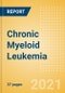 Chronic Myeloid Leukemia (CML) - Epidemiology Forecast to 2030 - Product Thumbnail Image