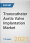 Transcatheter Aortic Valve Implantation Market by Procedure: Global Opportunity Analysis and Industry Forecast, 2021-2030 - Product Thumbnail Image