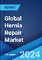 Global Hernia Repair Market Report by Product Type, Surgery Type, Hernia Type, End-User, and Region 2024-2032 - Product Image