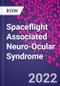 Spaceflight Associated Neuro-Ocular Syndrome - Product Image