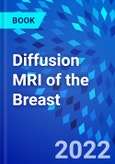 Diffusion MRI of the Breast- Product Image