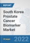 South Korea Prostate Cancer Biomarker Market: Prospects, Trends Analysis, Market Size and Forecasts up to 2027 - Product Thumbnail Image