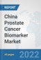 China Prostate Cancer Biomarker Market: Prospects, Trends Analysis, Market Size and Forecasts up to 2027 - Product Thumbnail Image