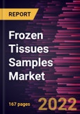 Frozen Tissues Samples Market Forecast to 2028 - COVID-19 Impact and Global Analysis By Product Type, Application and End User- Product Image