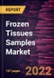 Frozen Tissues Samples Market Forecast to 2028 - COVID-19 Impact and Global Analysis By Product Type, Application and End User - Product Image