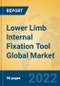 Lower Limb Internal Fixation Tool Global Market Insights 2022, Analysis and Forecast to 2027, by Manufacturers, Regions, Technology, Application, Product Type - Product Thumbnail Image