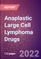 Anaplastic Large Cell Lymphoma Drugs in Development by Stages, Target, MoA, RoA, Molecule Type and Key Players - Product Thumbnail Image