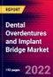 Dental Overdentures and Implant Bridge Market Report Suite - US - 2022-2028 - MedSuite - Product Thumbnail Image