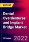 Dental Overdentures and Implant Bridge Market Report Suite - Europe - 2022-2028 - MedSuite - Product Thumbnail Image