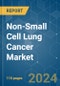 Non-Small Cell Lung Cancer (NSCLC) - Market Share Analysis, Industry Trends & Statistics, Growth Forecasts 2019 - 2029 - Product Thumbnail Image