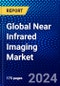 Global Near Infrared Imaging Market (2023-2028) Competitive Analysis, Impact of Covid-19, Ansoff Analysis - Product Thumbnail Image