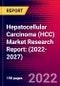 Hepatocellular Carcinoma (HCC) Market Research Report: (2022-2027) - Product Image