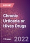 Chronic Urticaria or Hives Drugs in Development by Stages, Target, MoA, RoA, Molecule Type and Key Players, 2022 Update - Product Image