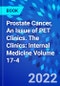 Prostate Cancer, An Issue of PET Clinics. The Clinics: Internal Medicine Volume 17-4 - Product Image
