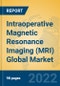 Intraoperative Magnetic Resonance Imaging (MRI) Global Market Insights 2022, Analysis and Forecast to 2027, by Manufacturers, Regions, Technology, Application, Product Type - Product Thumbnail Image