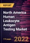 North America Human Leukocyte Antigen Testing Market Forecast to 2028 - COVID-19 Impact and Regional Analysis By Product and service, Technology, and End User - Product Thumbnail Image