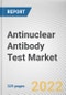 Antinuclear Antibody Test Market By Product, By Technique, By Application, By End-use: Global Opportunity Analysis and Industry Forecast, 2021-2031 - Product Thumbnail Image