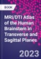 MRI/DTI Atlas of the Human Brainstem in Transverse and Sagittal Planes - Product Thumbnail Image