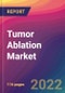 Tumor Ablation Market Size, Market Share, Application Analysis, Regional Outlook, Growth Trends, Key Players, Competitive Strategies and Forecasts - 2022 to 2030 - Product Image