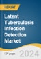 Latent Tuberculosis Infection Detection Market Size, Share & Trends Analysis Report by Brand (QFT-Plus), Test Type, Application, End-use, Region, and Segment Forecasts, 2024-2030 - Product Image