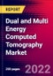 Dual and Multi Energy Computed Tomography Market by Type, Application, End User, and by Region - Global Forecast to 2022-2033 - Product Image