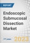 Endoscopic Submucosal Dissection Market by Product (Grasp, Clips, Gastroscopes, Colonoscopes), Indication (Cancer (Esophageal, Stomach, Colon), End User (Hospitals, Ambulatory Surgical Centers, Specialty Clinics) - Global Forecast to 2027 - Product Thumbnail Image