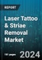 Laser Tattoo & Striae Removal Market by Procedure, End-use - Global Forecast 2025-2030 - Product Thumbnail Image