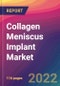 Collagen Meniscus Implant Market Size, Market Share, Application Analysis, Regional Outlook, Growth Trends, Key Players, Competitive Strategies and Forecasts, 2022 to 2030 - Product Thumbnail Image