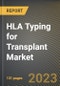 HLA Typing for Transplant Market Research Report by Technology, Product & Service, Application, End-User, State - Cumulative Impact of COVID-19, Russia Ukraine Conflict, and High Inflation - United States Forecast 2023-2030 - Product Thumbnail Image