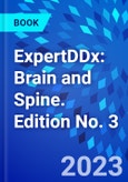 ExpertDDx: Brain and Spine. Edition No. 3- Product Image