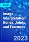 Image Interpretation: Bones, Joints, and Fractures - Product Image