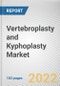 Vertebroplasty and Kyphoplasty Market By Product, By End User: Global Opportunity Analysis and Industry Forecast, 2021-2031 - Product Thumbnail Image