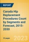 Canada Hip Replacement Procedures Count by Segments (Hip Resurfacing Procedures, Partial Hip Replacement Procedures and Others) and Forecast, 2015-2030 - Product Thumbnail Image