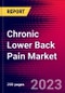 Chronic Lower Back Pain Market by Disease, by Diagnosis, by Treatment, by End User, and by Region - Global Forecast To 2022-2033 - Product Image