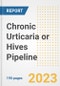 Chronic Urticaria or Hives Pipeline Report, 2023 - Planned Drugs by Phase, Mechanism of Action, Route of Administration, Type of Molecule, Market Trends, Developments, and Companies - Product Image