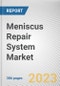 Meniscus Repair System Market By Product, By Application, By End User: Global Opportunity Analysis and Industry Forecast, 2021-2031 - Product Thumbnail Image
