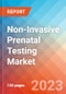 Non-Invasive Prenatal Testing - Market Insights, Competitive Landscape, and Market Forecast - 2028 - Product Image