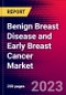 Benign Breast Disease and Early Breast Cancer Market by Treatment, End-User, and by Region - Global Forecast to 2023-2033 - Product Image