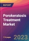 Porokeratosis Treatment Market Size, Market Share, Application Analysis, Regional Outlook, Growth Trends, Key Players, Competitive Strategies and Forecasts, 2023 to 2031 - Product Image