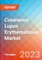 Cutaneous Lupus Erythematosus - Market Insight, Epidemiology And Market Forecast - 2032 - Product Image