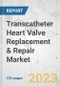 Transcatheter Heart Valve Replacement & Repair Market - Global Industry Analysis, Size, Share, Growth, Trends, and Forecast, 2023-2031 - Product Image