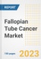 Fallopian Tube Cancer Market Analysis, 2023 - Industry Trends, Market Size, Growth Opportunities, Market Share, Forecast by Types, Applications, Countries, and Companies, 2018 to 2030 - Product Image