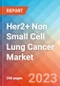 Her2+ Non Small Cell Lung Cancer - Market Insight, Epidemiology and Market Forecast - 2032 - Product Image