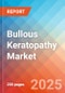 Bullous Keratopathy - Market Insights, Epidemiology, and Market Forecast - 2032 - Product Image