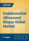 Endobronchial Ultrasound Biopsy Global Market Insights 2023, Analysis and Forecast to 2028, by Manufacturers, Regions, Technology, Application, Product Type - Product Thumbnail Image