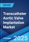 Transcatheter Aortic Valve Implantation Market by Procedure, End User, and Region 2023-2028 - Product Thumbnail Image